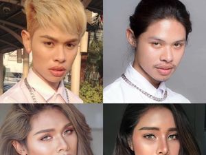 Pria Ini Operasi Plastik Demi Mirip Aktris Idola, Jadi Beda Banget!