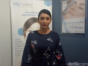 Ditantang Kembalikan Amandine dalam 1x24 Jam, Ini Kata Tyas Mirasih