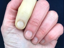 Foto Viral Jari Wanita yang Menunjukkan Warna Kontras