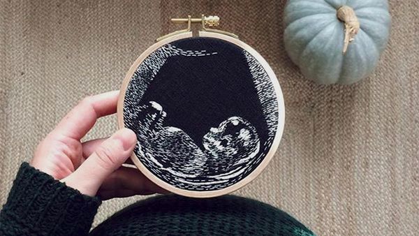 Cantik Banget! Saat Foto USG Dijadikan Sulaman