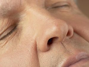 Mimisan 3 Bulan dan Ada Benjolan, Hidung Pria Ini Terinfeksi Parasit