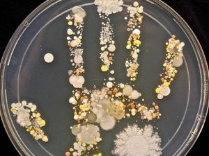 Foto-Foto Cantik Ini Tunjukkan Penampakan Koloni Bakteri di Tangan Foto-Foto Cantik Ini Tunjukkan Penampakan Koloni Bakteri di Tangan