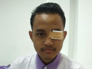 Viral Pemuda yang Matanya Infeksi Berat Karena Abu Rokok Pemotor