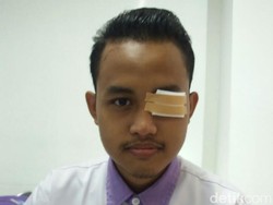 Viral Pemuda yang Matanya Infeksi Berat Karena Abu Rokok Pemotor