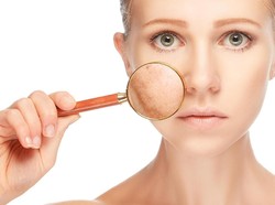 Apa Benar Makan Mangga Bisa Bikin Wajah Jerawatan?