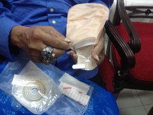 Susah Dapat Kantong Stoma, Pasien Kanker Sempat Gunakan Plastik Gula Susah Dapat Kantong Stoma, Pasien Kanker Sempat Gunakan Plastik Gula