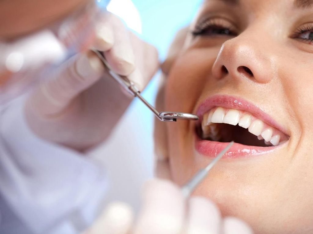 6 Cara Menghilangkan Karang Gigi yang Membandel