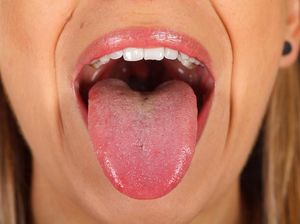 Apa yang Menyebabkan Lidah Wanita Ini Ditumbuhi Bulu Hitam? Apa yang Menyebabkan Lidah Wanita Ini Ditumbuhi Bulu Hitam?