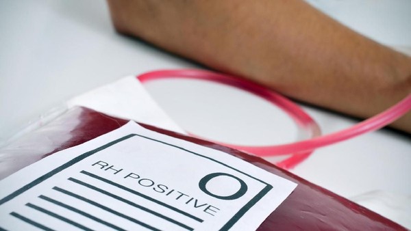 Foto: ilustrasi/thinkstock
