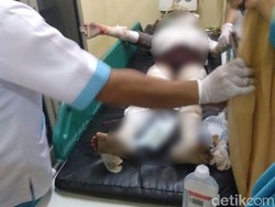 Ibu dan Anak Ditemukan Terbakar di Sawah, Polisi Selidiki