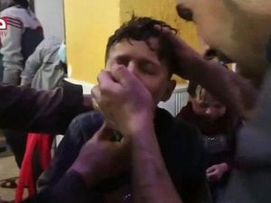 Serangan Kimia Suriah, AS: Hanya Monster yang Targetkan Warga