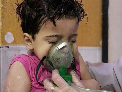 Potret Menyedihkan Anak-anak Korban Serangan Kimia di Suriah