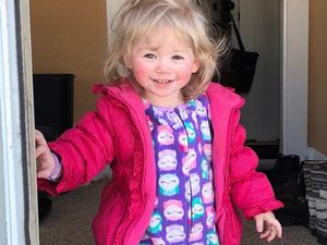 Kini Tak Bisa Nangis atau Berkeringat, Alergi Air Balita Ini Memburuk