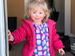 Kini Tak Bisa Nangis atau Berkeringat, Alergi Air Balita Ini Memburuk