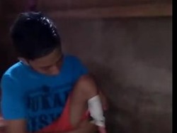 Mensos Kirim Bantuan Kaki Palsu ke Bocah yang Curhat ke Jokowi