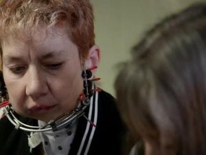 Hancur Karena Kanker, Rahang Wanita Ini Ditumbuhkan Kembali