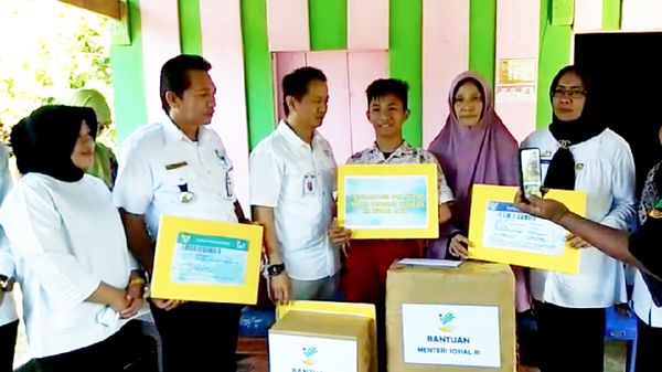 Momen Bocah yang Curhat ke Jokowi Dapatkan Kaki Palsu