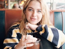 Curhat Putri Noel Gallagher Soal Masalah Kulit yang Dialaminya