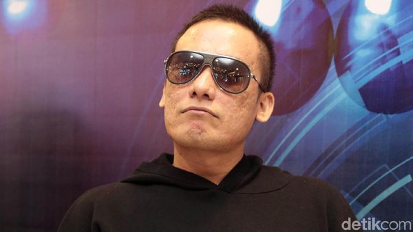 Gaya Konyol Firman Eks Idol saat Pose Depan Kamera