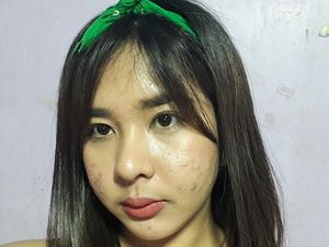 Balasan Menohok Wanita yang Diejek Menjijikan karena Berjerawat