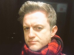 Vokalis The Overtones Meninggal Dunia