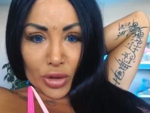 Ingin Ubah Warna Mata, Model Ini Nyaris Buta Setelah Operasi Ingin Ubah Warna Mata, Model Ini Nyaris Buta Setelah Operasi