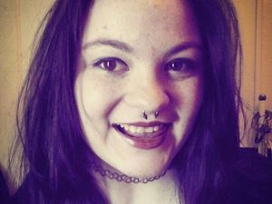 3 Tahun Nyeker Tak Pakai Sepatu, Kaki Kassandra Jadi Seperti Ini