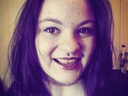 3 Tahun Nyeker Tak Pakai Sepatu, Kaki Kassandra Jadi Seperti Ini