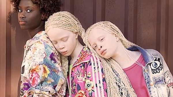 Cantiknya Rare Flowers Lara dan Mara, Kembar Albino Langka