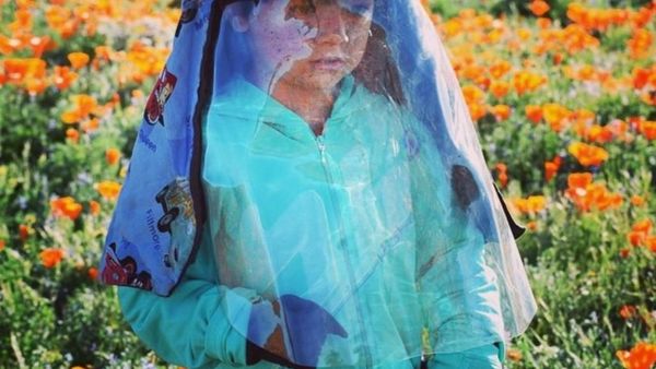 Potret Kehidupan Anak Laki-laki yang Tak Bisa Kena Sinar Matahari