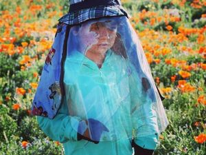 Potret Kehidupan Anak Laki-laki yang Tak Bisa Kena Sinar Matahari