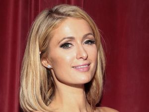 Paris Hilton Ternyata Anti Operasi Plastik, Lebih Suka Perawatan Alami