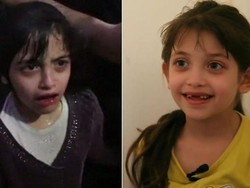 Cerita Pilu Anak di Suriah Berjuang saat Kena Serangan Kimia