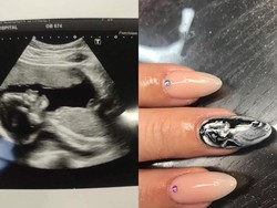 Unik! Ketika Kuku Dihiasi Gambar USG Kehamilan