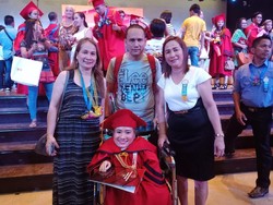 Cacat Bukan Halangan! Mahasiswi Ini Lulus dengan Predikat Magna Cum Laude