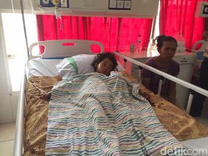 Cerita Alda, Bocah Terbakar yang Tak Bisa Berobat Karena Biaya