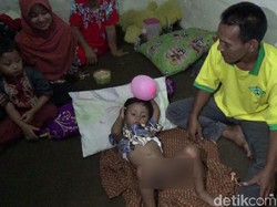 Ini Kata Ahli Andrologi Terkait Bocah 4 Tahun Disunat Jin