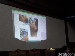 Jaksa KPK Tampilkan Visum Luka Setya Novanto di Sidang