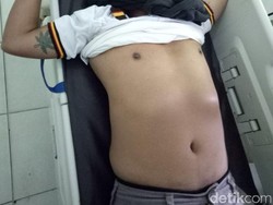 Siram Petugas dengan Air Cabe, Tahanan Narkoba Ditembak!