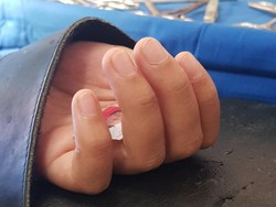 Viral ABG Genggam Foto Pacar, Ini Sederet Kelakuan Unik Pasien Saat Operasi