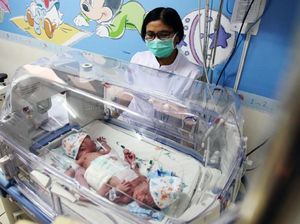 Kepasrahan Orang Tua Bayi Kembar Siam Kaki Tiga Asal Subang