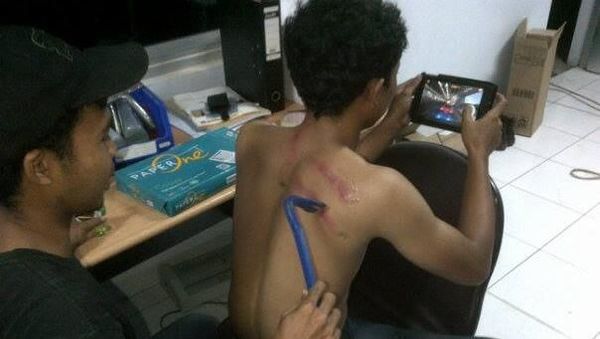 7 Gambar Lucu Alat-alat Kesehatan Alternatif