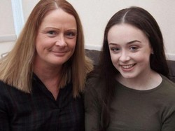 Gara-gara Kawat Gigi, Remaja Cantik Ini Stroke dan Harus Operasi Jantung