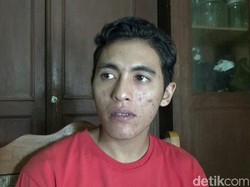 Ini Cerita Korban Selamat Pesta Miras Oplosan di Banyuwangi