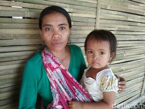 4 Dampak Besar Masalah Stunting Anak Bila Dibiarkan