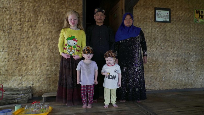 Kisah Walanda Sunda di Kampung Albino Ciburuy