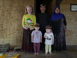 Kisah Walanda Sunda di Kampung Albino Ciburuy
