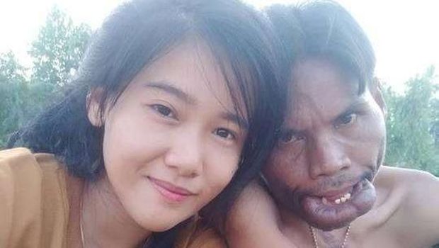 {Minggu} Cinta Sejati Tak Memandang Fisik, 5 Pasangan Ini Membuktikannya