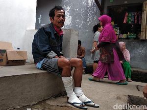 Cerita Horor Korban Luka Ledakan Gas Melon Bandung