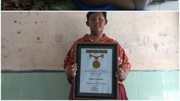 Foto: Before-After Ariya Bocah Terberat Sedunia yang Susut 80 Kg